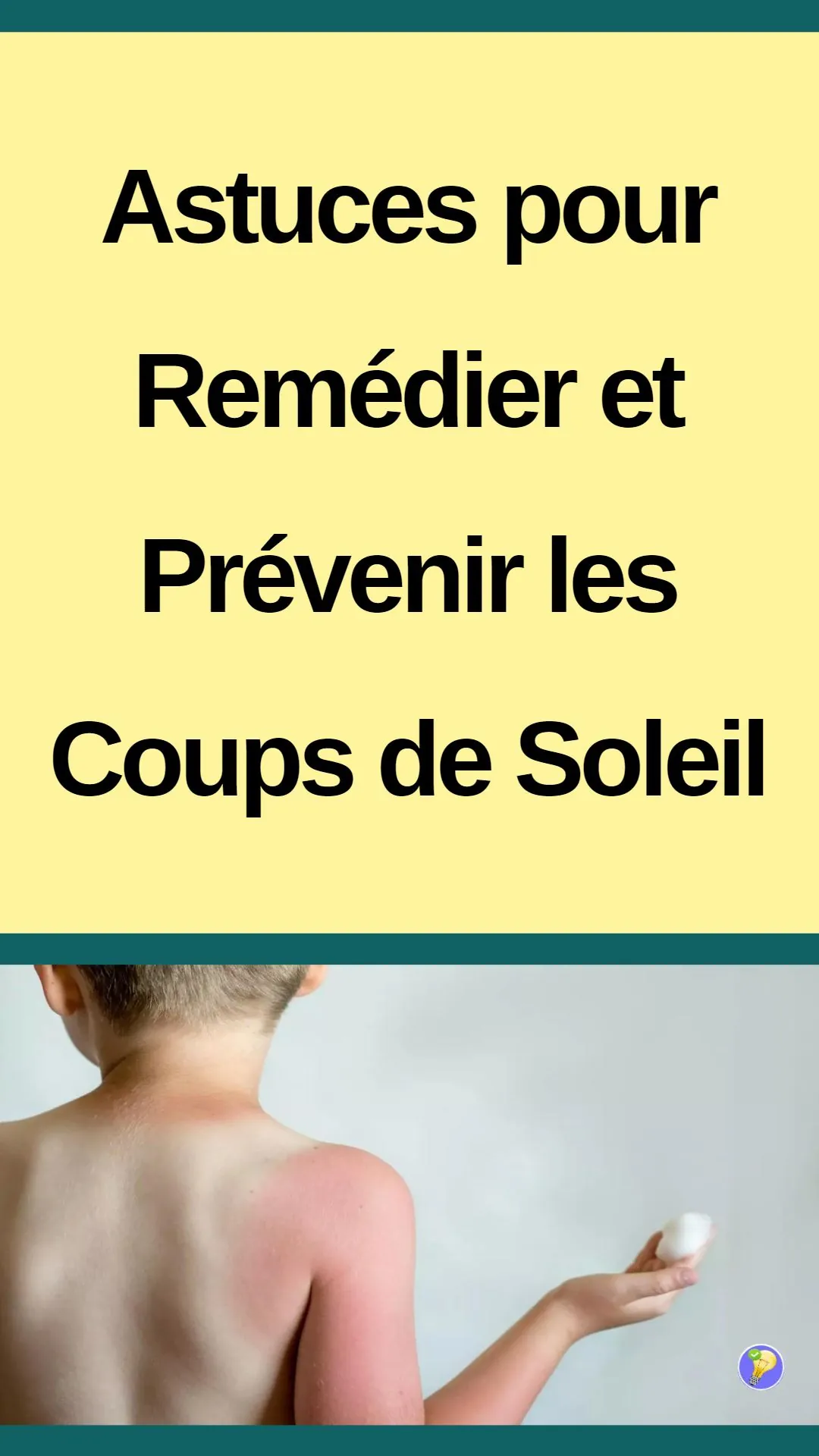Remèdes naturels et conseils préventifs contre les coups de soleil 